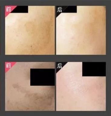 https://img.miyanlife.com/mnt/timg/180513/11305V4W-5.jpg