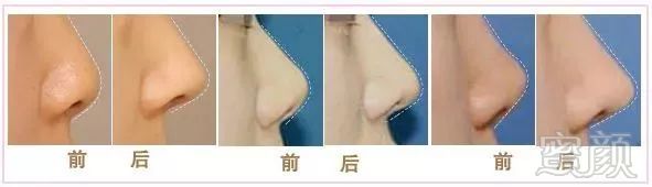 https://img.miyanlife.com/mnt/timg/180513/120P22554-7.jpg