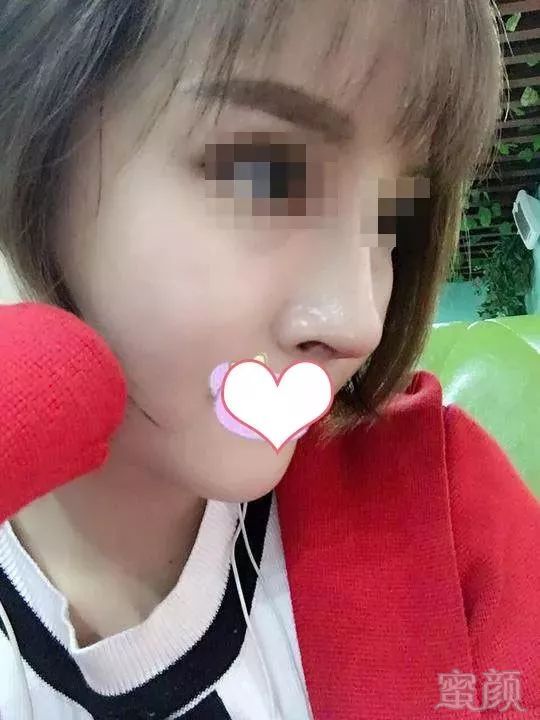 https://img.miyanlife.com/mnt/timg/180513/120P32504-11.jpg