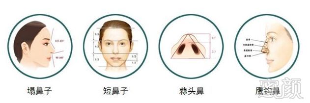 https://img.miyanlife.com/mnt/timg/180513/120P4I32-13.jpg