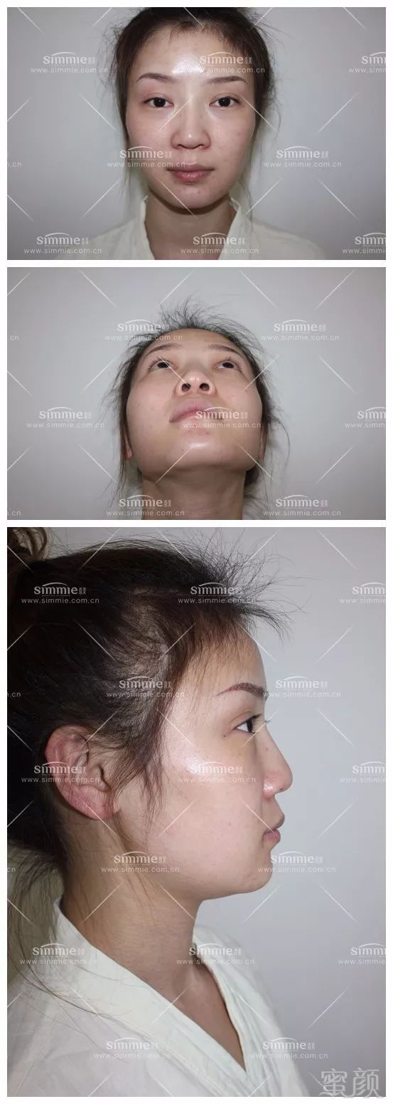 https://img.miyanlife.com/mnt/timg/180513/12123341V-1.jpg