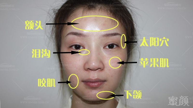 https://img.miyanlife.com/mnt/timg/180513/1212361N2-2.jpg