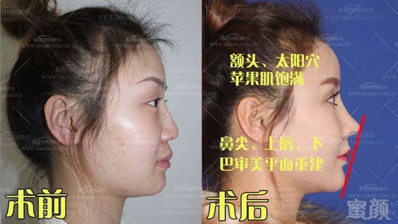 https://img.miyanlife.com/mnt/timg/180513/12123Q943-6.jpg