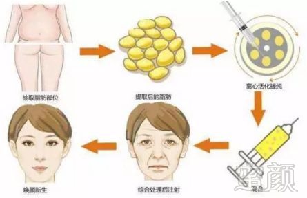 https://img.miyanlife.com/mnt/timg/180513/12123V525-4.jpg
