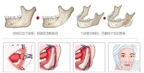 https://img.miyanlife.com/mnt/timg/180513/1216212233-3.jpg