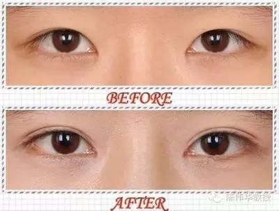 https://img.miyanlife.com/mnt/timg/180514/102H03V3-1.jpg