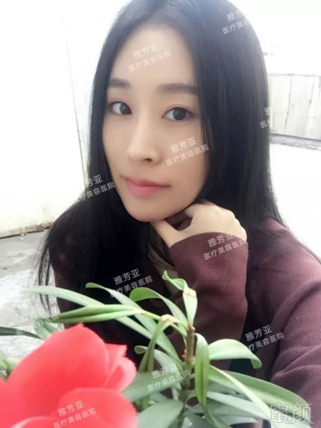 https://img.miyanlife.com/mnt/timg/180514/1055314418-5.jpg