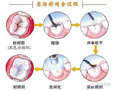 案例图片