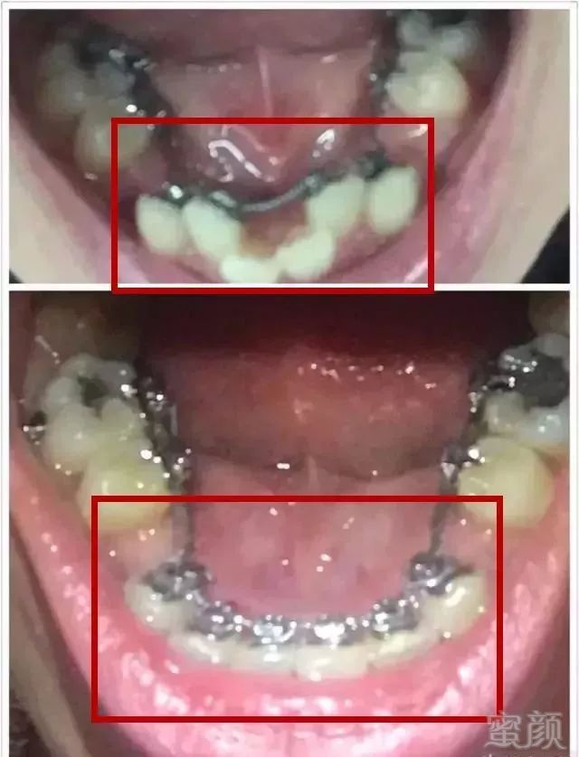 https://img.miyanlife.com/mnt/timg/180514/114Q25362-4.jpg