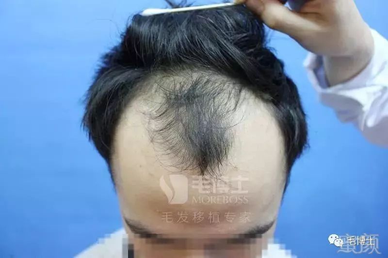 https://img.miyanlife.com/mnt/timg/180514/1156201956-0.jpg