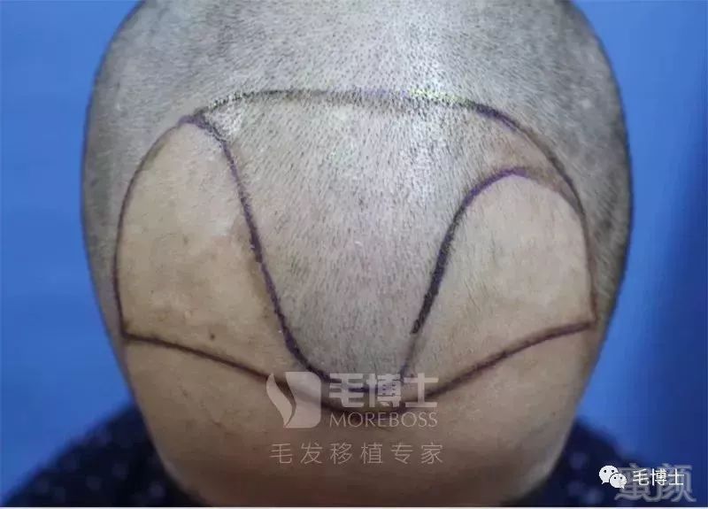 https://img.miyanlife.com/mnt/timg/180514/1156213615-2.jpg