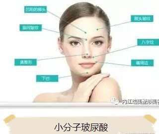 https://img.miyanlife.com/mnt/timg/180514/1205504Q4-3.jpg