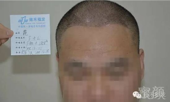 https://img.miyanlife.com/mnt/timg/180514/1206015639-3.jpg