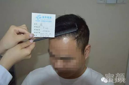 https://img.miyanlife.com/mnt/timg/180514/1206021937-5.jpg
