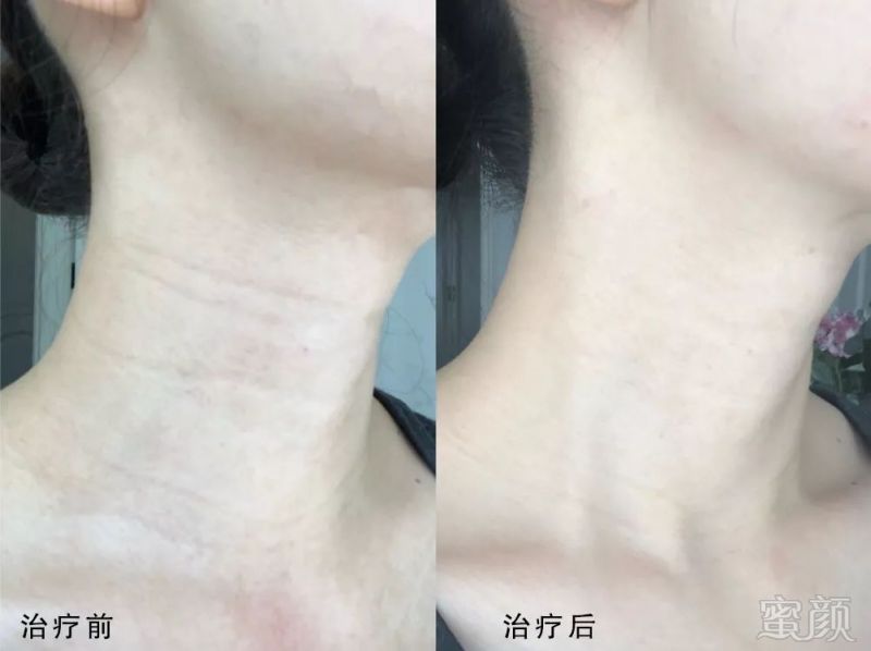 https://img.miyanlife.com/mnt/timg/180515/105I2K61-10.jpg