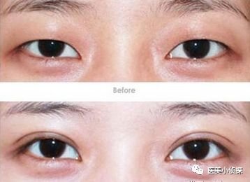https://img.miyanlife.com/mnt/timg/180515/1103005M1-1.jpg