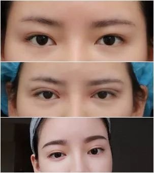 https://img.miyanlife.com/mnt/timg/180515/110Z23142-0.jpg