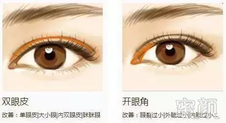 https://img.miyanlife.com/mnt/timg/180515/112412F16-3.jpg