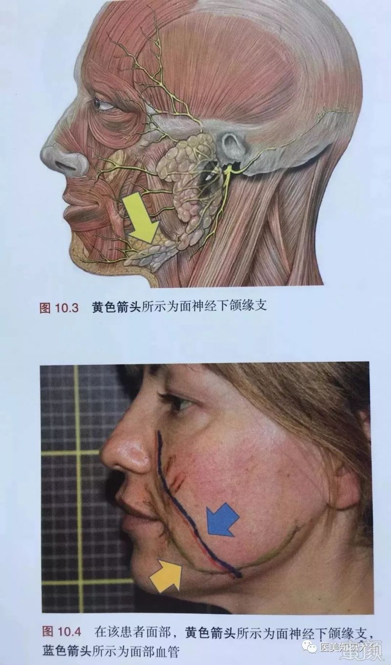 https://img.miyanlife.com/mnt/timg/180515/112U23L7-1.jpg