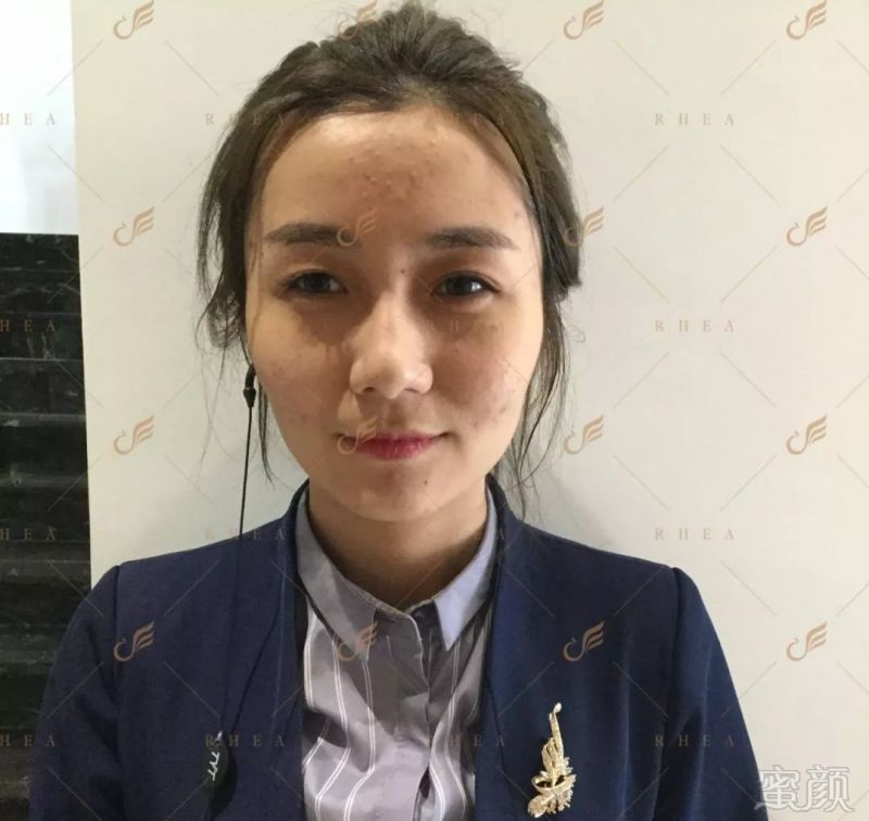 https://img.miyanlife.com/mnt/timg/180515/1134021N5-5.jpg