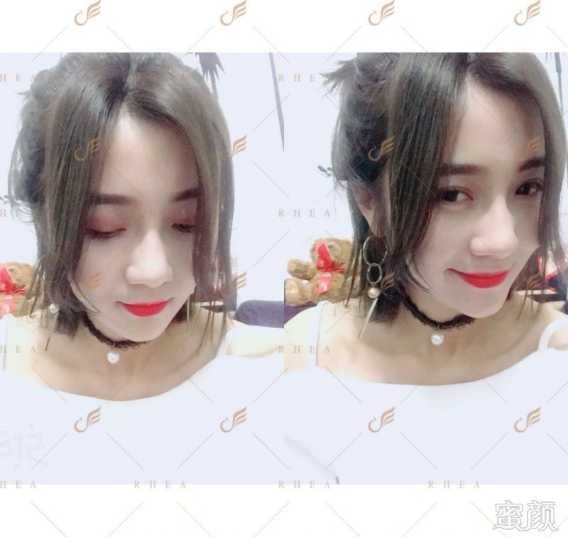 https://img.miyanlife.com/mnt/timg/180515/1134051510-8.jpg