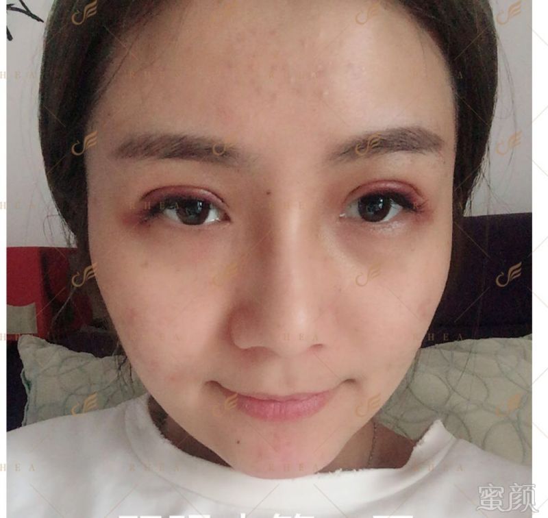 https://img.miyanlife.com/mnt/timg/180515/1134055402-7.jpg