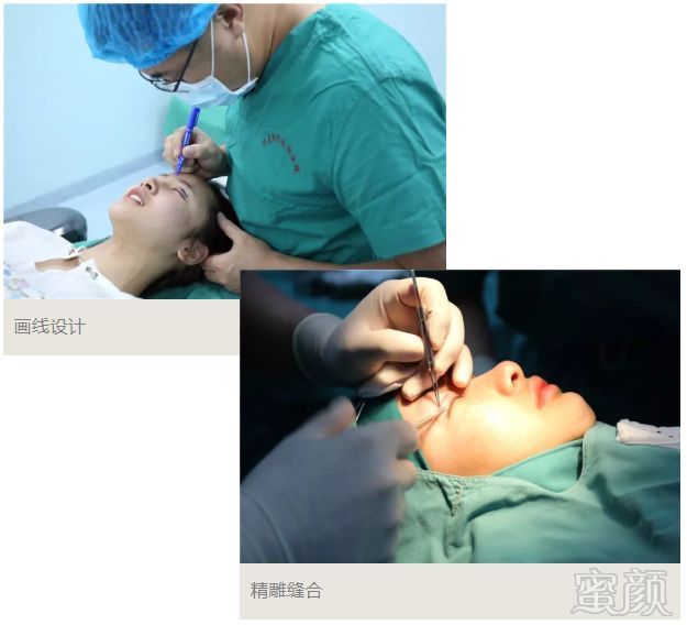 https://img.miyanlife.com/mnt/timg/180515/113ZL312-2.jpg