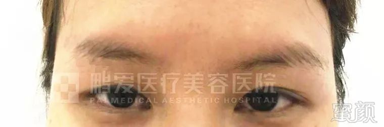https://img.miyanlife.com/mnt/timg/180515/1210313946-3.jpg