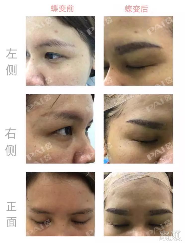 https://img.miyanlife.com/mnt/timg/180515/121035F14-8.jpg