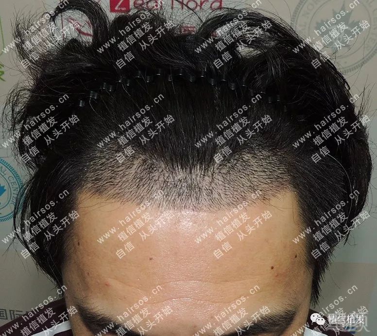 https://img.miyanlife.com/mnt/timg/180516/1213042E1-2.jpg