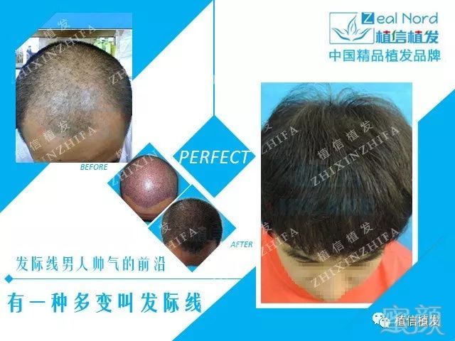 https://img.miyanlife.com/mnt/timg/180516/1213064395-3.jpg