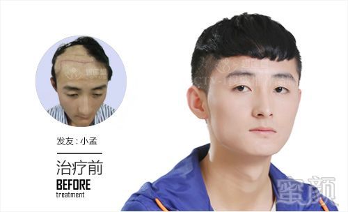 https://img.miyanlife.com/mnt/timg/180516/12164J2V-1.jpg