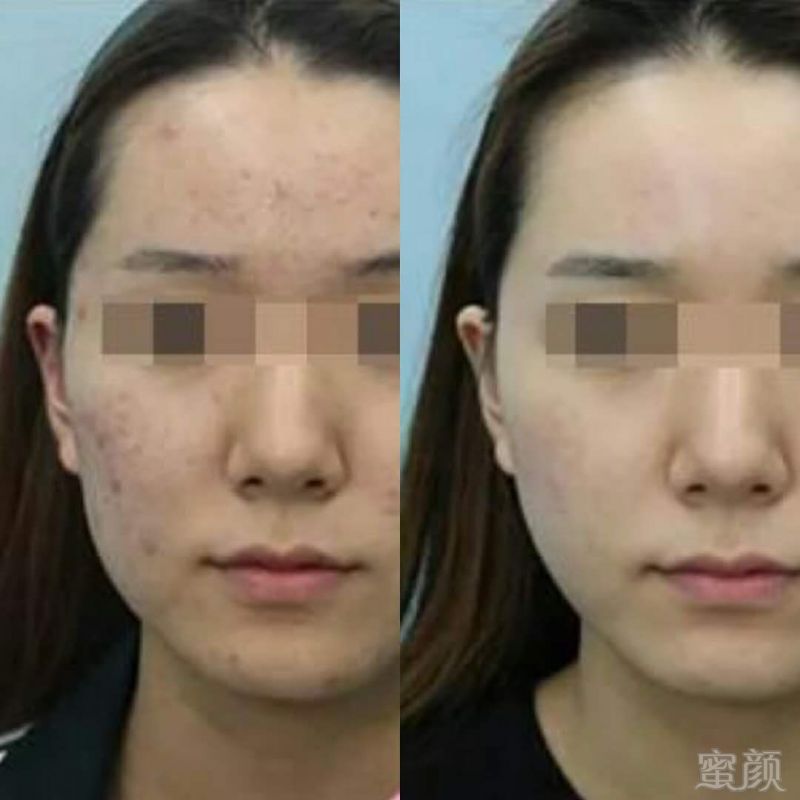 https://img.miyanlife.com/mnt/timg/180516/12530V521-2.jpg