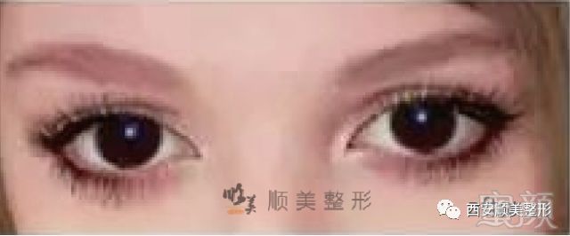 https://img.miyanlife.com/mnt/timg/180516/13003H216-14.jpg