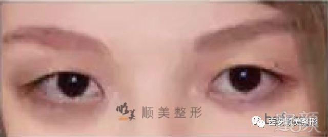 https://img.miyanlife.com/mnt/timg/180516/13003MO6-15.jpg