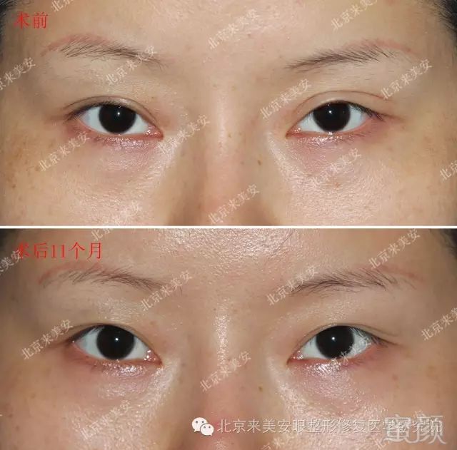 https://img.miyanlife.com/mnt/timg/180516/13163a146-1.jpg