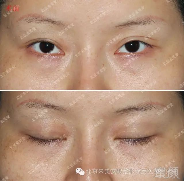 https://img.miyanlife.com/mnt/timg/180516/13163aW5-2.jpg