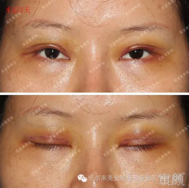 https://img.miyanlife.com/mnt/timg/180516/1316402216-4.jpg