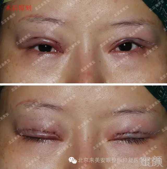 https://img.miyanlife.com/mnt/timg/180516/1316406196-3.jpg