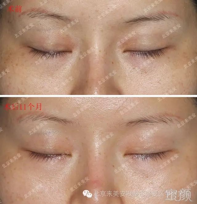 https://img.miyanlife.com/mnt/timg/180516/1316413045-7.jpg