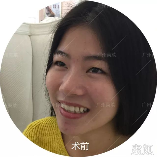 https://img.miyanlife.com/mnt/timg/180517/1022551b7-1.jpg