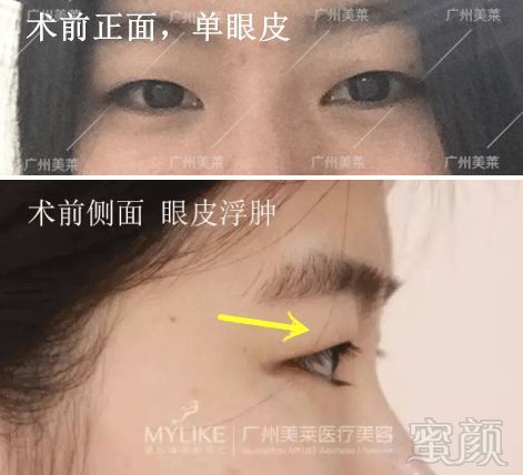 https://img.miyanlife.com/mnt/timg/180517/1022555117-2.jpg