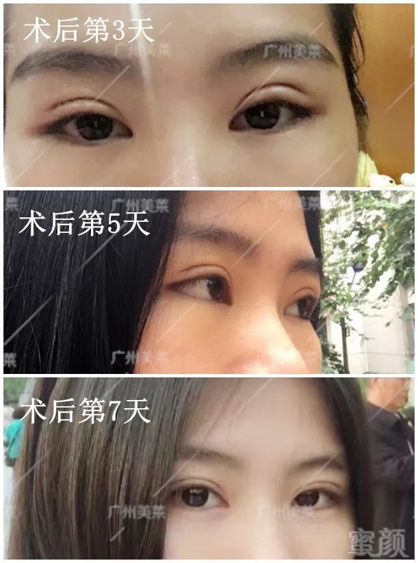 https://img.miyanlife.com/mnt/timg/180517/10225IO5-4.jpg