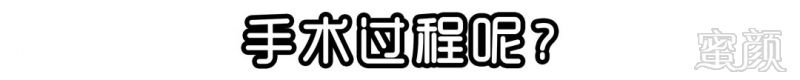 https://img.miyanlife.com/mnt/timg/180517/10225S529-8.jpg