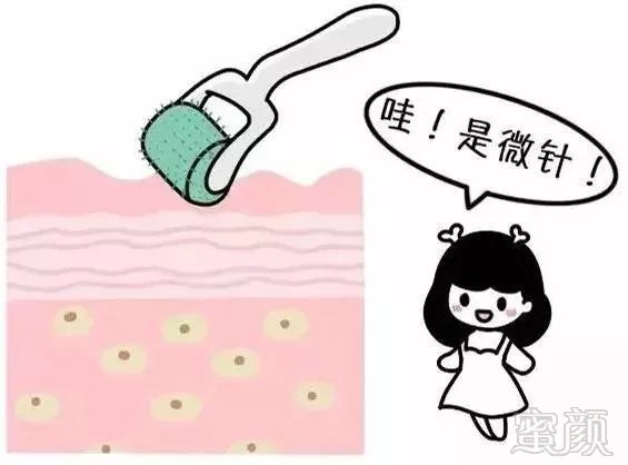 https://img.miyanlife.com/mnt/timg/180517/114GVb8-5.jpg