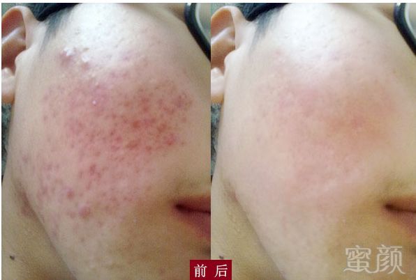 https://img.miyanlife.com/mnt/timg/180517/114H32351-15.jpg