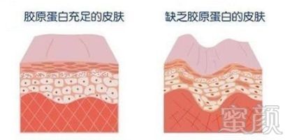 https://img.miyanlife.com/mnt/timg/180517/11550Q3S-4.jpg