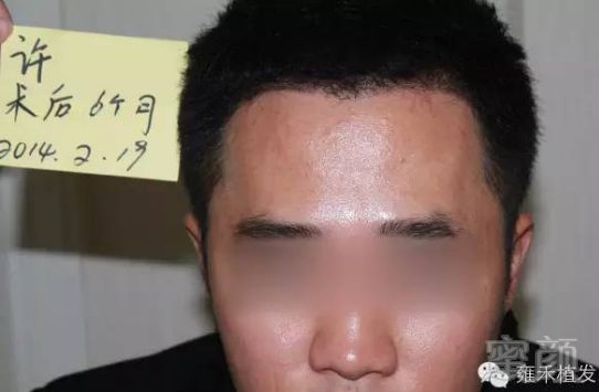 https://img.miyanlife.com/mnt/timg/180517/12460910P-6.jpg