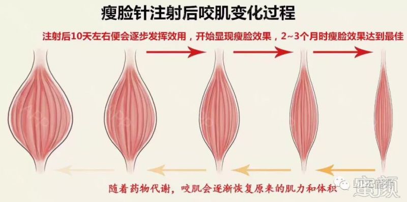 https://img.miyanlife.com/mnt/timg/180517/130I54G4-0.jpg
