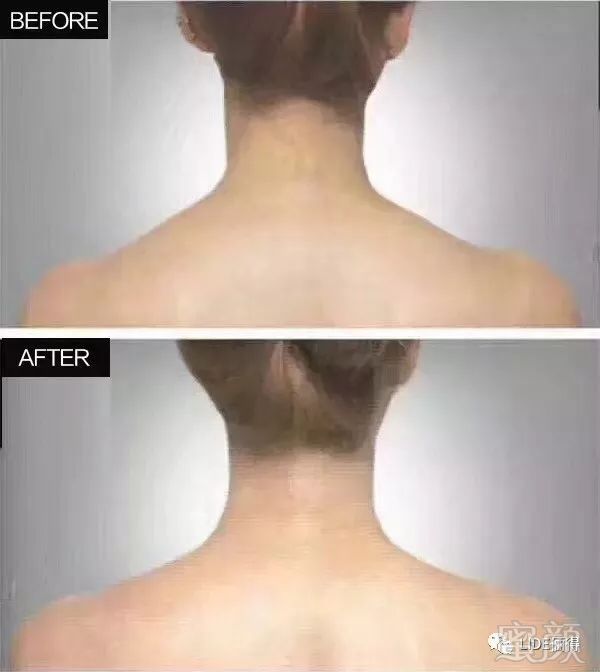 https://img.miyanlife.com/mnt/timg/180517/130I62c4-2.jpg